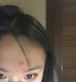 痘痘吃瓜,揭秘痘痘成因与饮食调理之道  第3张